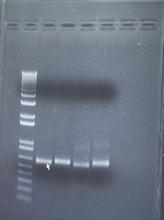 electrophoresis gel showing results from PCR-amplified samples