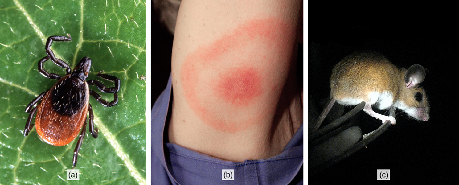 Photo (a) shows a deer tick on a leaf. The tick has a brown oval body with a smaller, round oval toward the front. The head and legs are black. Photo (b) shows an arm with a red, circular rash enclosed in a ring-like rash. Photo (c) shows a brown mouse with a white belly and legs and large, round ears.