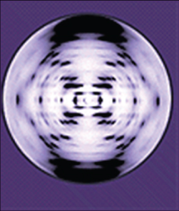The x-ray diffraction pattern is symmetrical, with dots in an x-shape