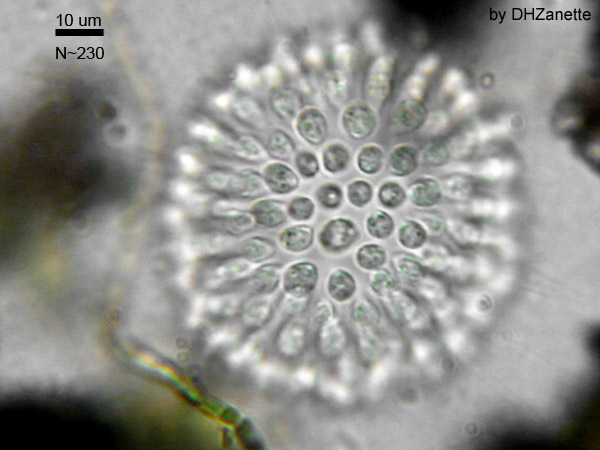 Colonial Choanoflagellate. Has a central structure with a series of circular cells.