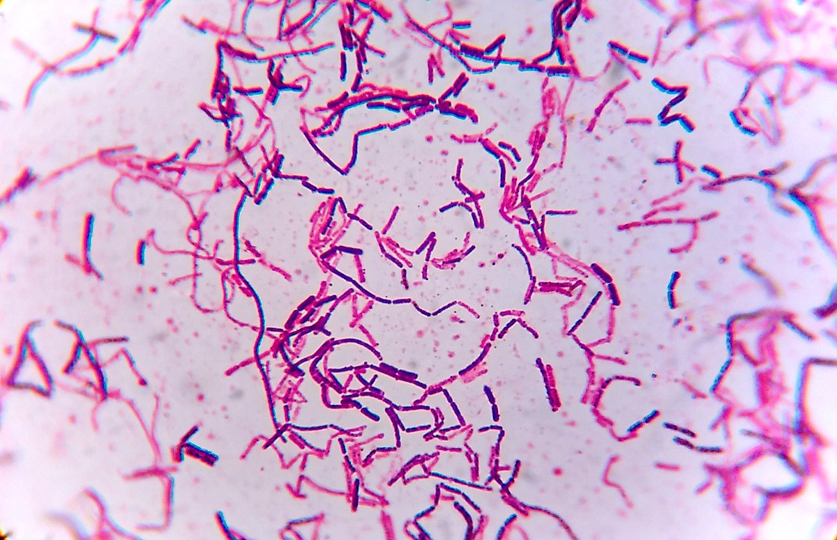 initial Gram stain with Gram positive and Gram negative rods