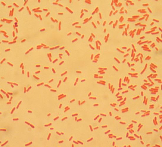 alpha isolated Gram stain showing pink rods