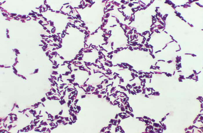 Beta Gram stain showing purple rods