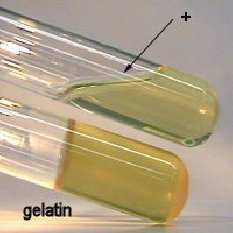 gelatin hydrolysis test showing gelatin hydrolysis positive results and gelatin hydrolysis negative results