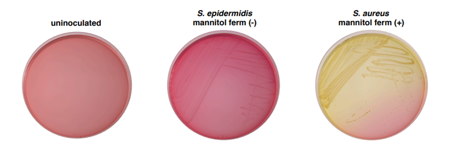 mannitol salts agar results showing mannitol fermentation negative result and mannitol fermentation positive result