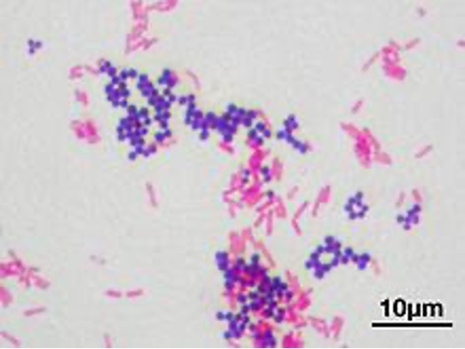 Two types of Gram-stained bacteria: purple spheres and pink rods