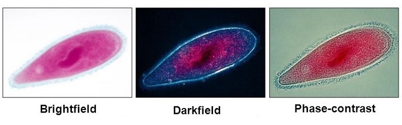 A paramecium shown under bright field, dark field, and phase contrast microscopy. 