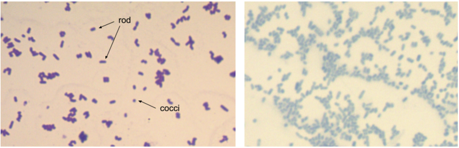 C. xerosis and P. vulgaris cell morphology