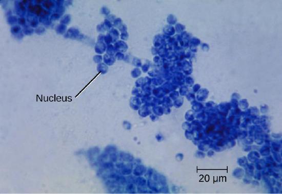 A light micrograph with a clear background and blue cells. A long row of cells forms a central strand. Attached to this are clusters of many spherical cells. Each cell is approximately 5 µm in size and contains a nucleus.