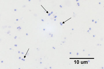 A photomicrograph of the diplococcus <i>Neisseria gonorrhoeae</i> taken with oil immersion microscopy showing showing cocci arranged in pairs.