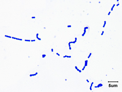 A photomicrograph or <i>Streptococcus pyogenes</i>, taken with oil immersion microscopy, showing its streptococcus arrangement.