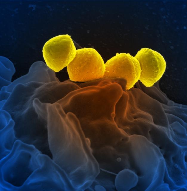 A scanning electron micrograph of <i>Streptococcus pyogenes</i> showing a chain of cocci.