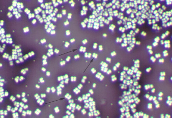 Photomicrograph of an indirect stain of <i>Micrococcus luteus</i>, taken with oil immersion microscopy, showing several  tetrad arrangements of cocci.