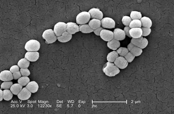 A scanning electron micrograph of <em>Micrococcus luteus </em> showing several tetrad arrangements of cocci.