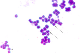A photomicrograph of <i>Micrococcus luteus</i> a bacterium, taken with oil immersion microscopy, showing a sarcina arrangement of cocci.