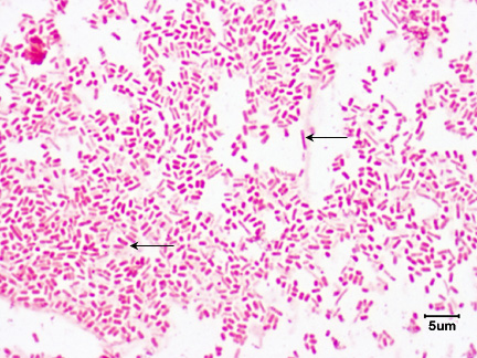 A photomicrograph of <i>Escherichia coli</i>, taken using oil immersion microscopy, showing single bacillus arrangements.