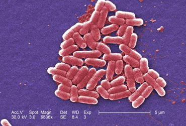 A scanning electron micrograph of <i>Escherichia coli</i> O157H7 showing single bacilli.