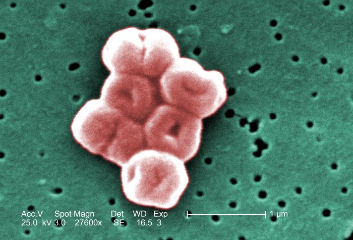 A scanning electron micrograph of an Acinetobacter</i>, showing coccobacilli.