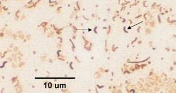 A photomicrograph of a <i>Vibrio</i> species, taken using oil immersion microscopy, and showing vibrio <curved bacillus) forms.
