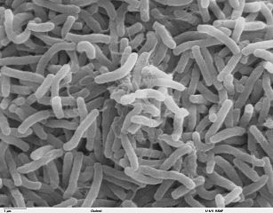 A scanning electron micrograph of <i>Vibrio cholerae</i> showing vibrio (curved bacillus) forms.