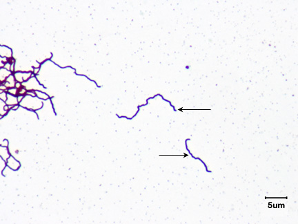 A photomicrograph of <i>Treponema pallidum</i>, a spirochete (thin, flexible spirals), taken using oil immersion microscopy.