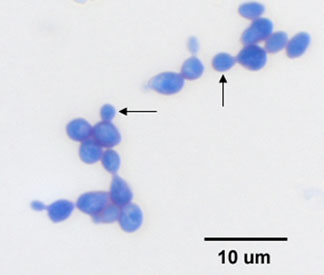 Direct stain of <i>Saccharomyces cerevisiae</i> (Baker's yeast), as seen using oil immersion microscopy, and showing asexual reproduction by budding.
