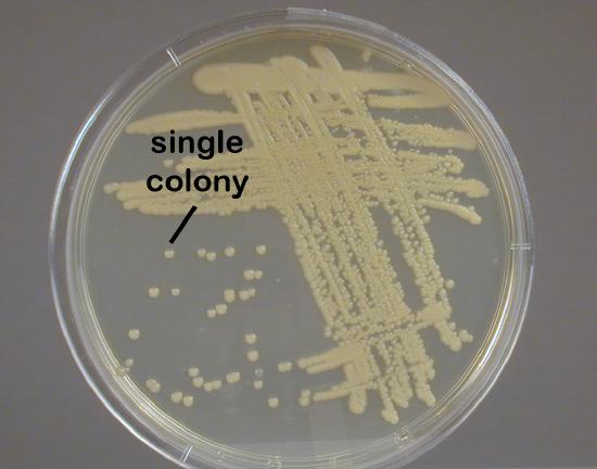 Photograph showing isolated colonies of <i>Micrococcus luteus</i>