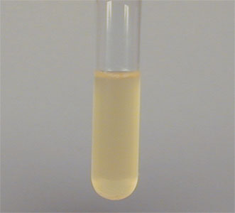 Photograph of a broth culture tube.