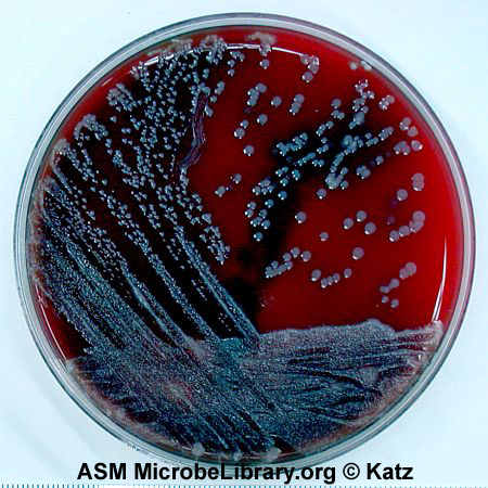 Streak plate of a fecal smear on blood agar showing isolated colonies.