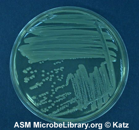Streak plate of <i>Escherichia coli</i> showing isolated colonies.