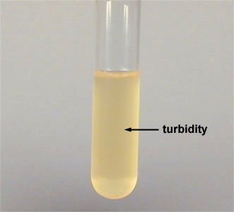 Photograph of a broth culture showing turbidity.