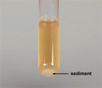Photograph of a broth culture showing sediment.