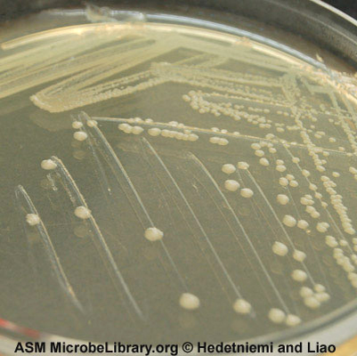 Photograph of an agar plate showing isolated colonies of <i>Escherichia coli</i>.