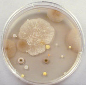 Photograph of an agar plate exposed to the air for 1 hour and incubated. It shows numerous bacterial and mold colonies.
