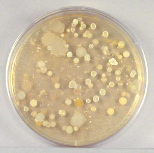 Photograph of an agar plate streaked with a swab rubbed ofer the bottom of a shoe and incubated. It shows many bacterial and mold colonies.