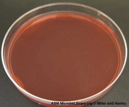Photograph showing an uninoculated plate of MacConkey agar.