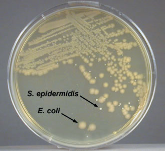 Photograph of an isolation plate showing a mixture of <i>Escherichia coli </i> and <i>Staphylococcus epidermidis</i> growing on TSA.