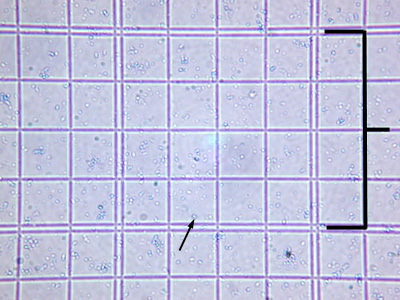 Photomicrograph of a double-lined square of a Petroff-Hausser counting chamber.