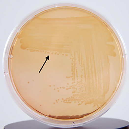 Photograph showing Proteus mirabilis</EM> growing on MacConkey agar.