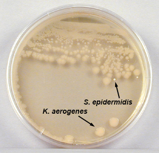 Photograph showing an isolation plate with a mixture of <em>Klebsiella aerogenes </em> and <i>Staphylococcus epidermidis</i> growing on TSA.