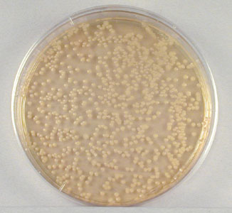 Photograph showing colonies on a 1/100,000 dilution plate during the plate count procedure.