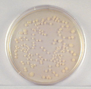 Photograph showing colonies on a 1/1,000,000 dilution plate during the plate count procedure.