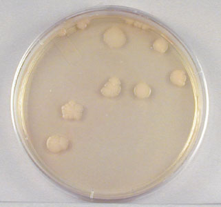 Photograph showing colonies on a 1/10,000,000 dilution plate during the plate count procedure.