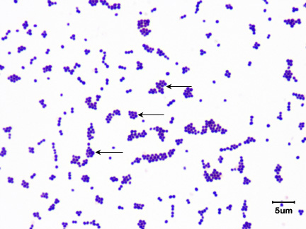 Photomicrograph of a Gram stain of <i>Staphylococcus aureus</i> showing Gram-positive cocci with a staphylococcus arrangement.
