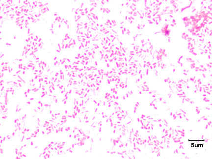 Photomicrograph of a Gram stain of <i>Escherichia coli</i> showing Gram-negative bacilli.