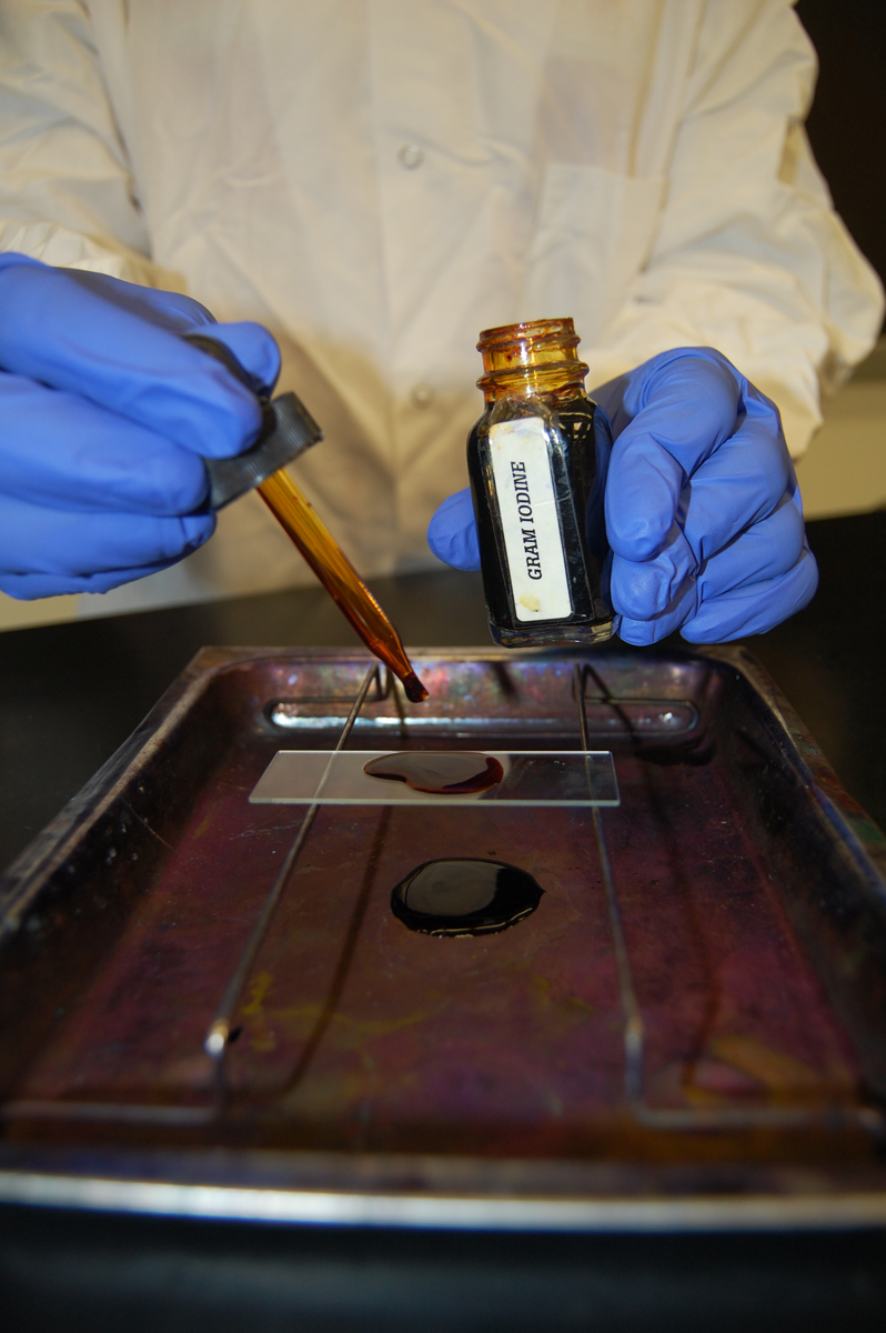 Photograph showing how add Gram's iodine to the slide.