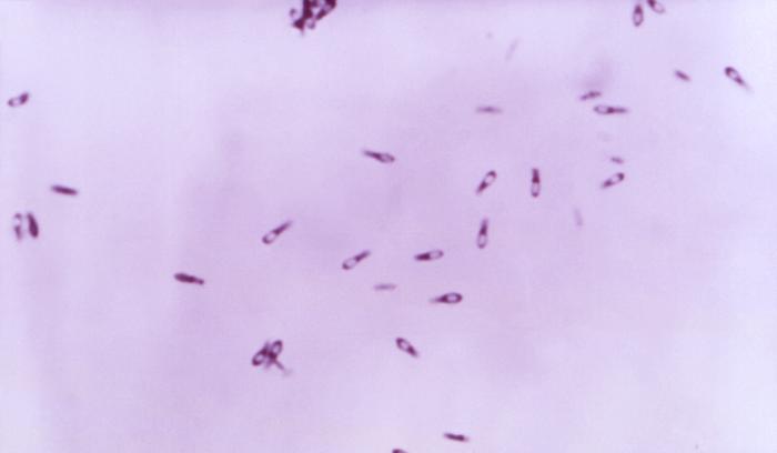 Photomicrograph of a Gram stain of <i>Clostridium perfringens</i> showing Gram-positive bacilli with colorless endospores.