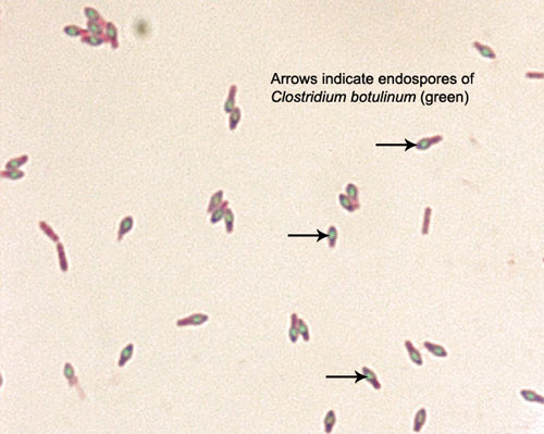 Photomicrograph of an endospore stain of <i>Clostridium botulinum showing green endospores within red vegetative cells.