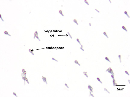 Photomicrograph of an endospore stain of <i>Clostridium tetani</i> showing endospores within vegetative cells and the characteristic tennis racquet shape of a <i>Clostridium</i> with an endospore.