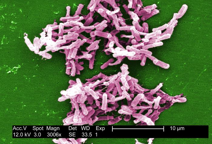 Scanning electron micrograph of <i>Clostridioides difficile</i> showing clumps of bacilli.